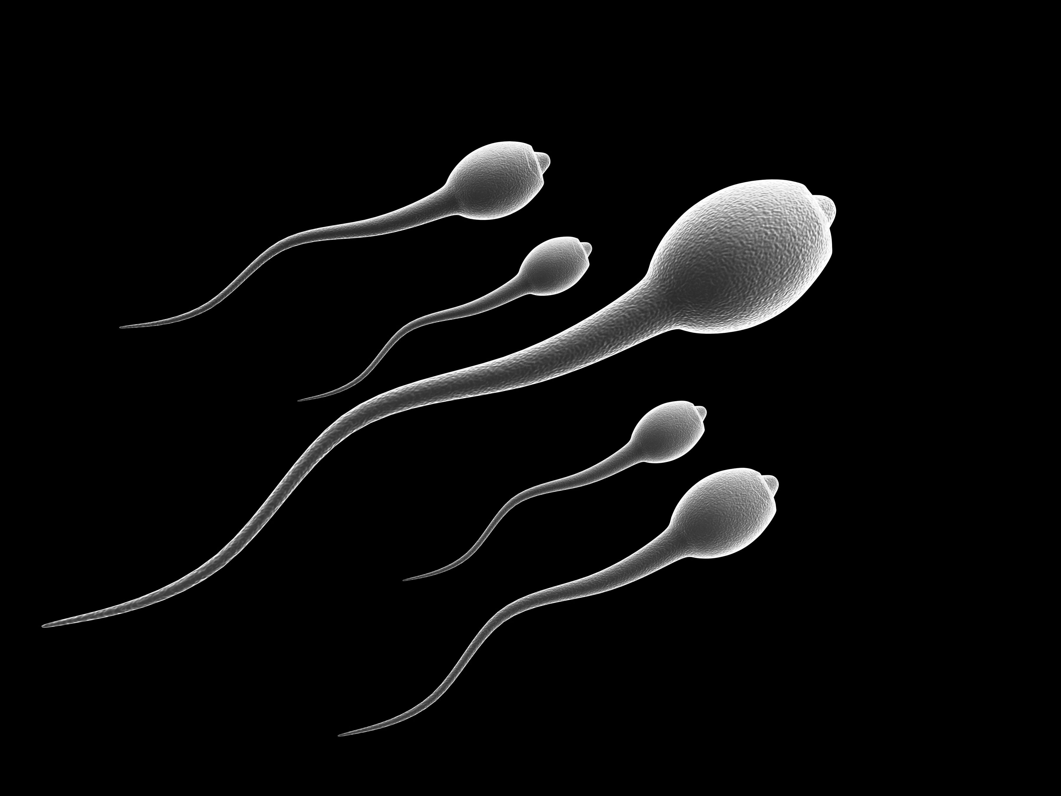 Male sperm color