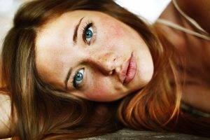 Lindsay Hansen, Freckles