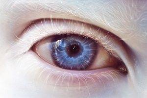 eyes, Albino