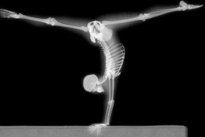 x rays, Gymnastics, Bones, Human body