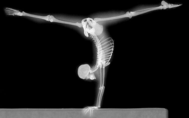 x rays, Gymnastics, Bones, Human body HD Wallpaper Desktop Background