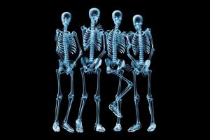 x rays, Skeleton