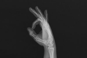 hands, Fingers, Bones, X rays
