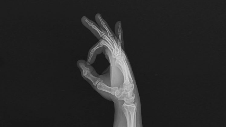 hands, Fingers, Bones, X rays HD Wallpaper Desktop Background