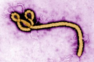 ebola, Virus, Disease, Medical, Dark, Horror