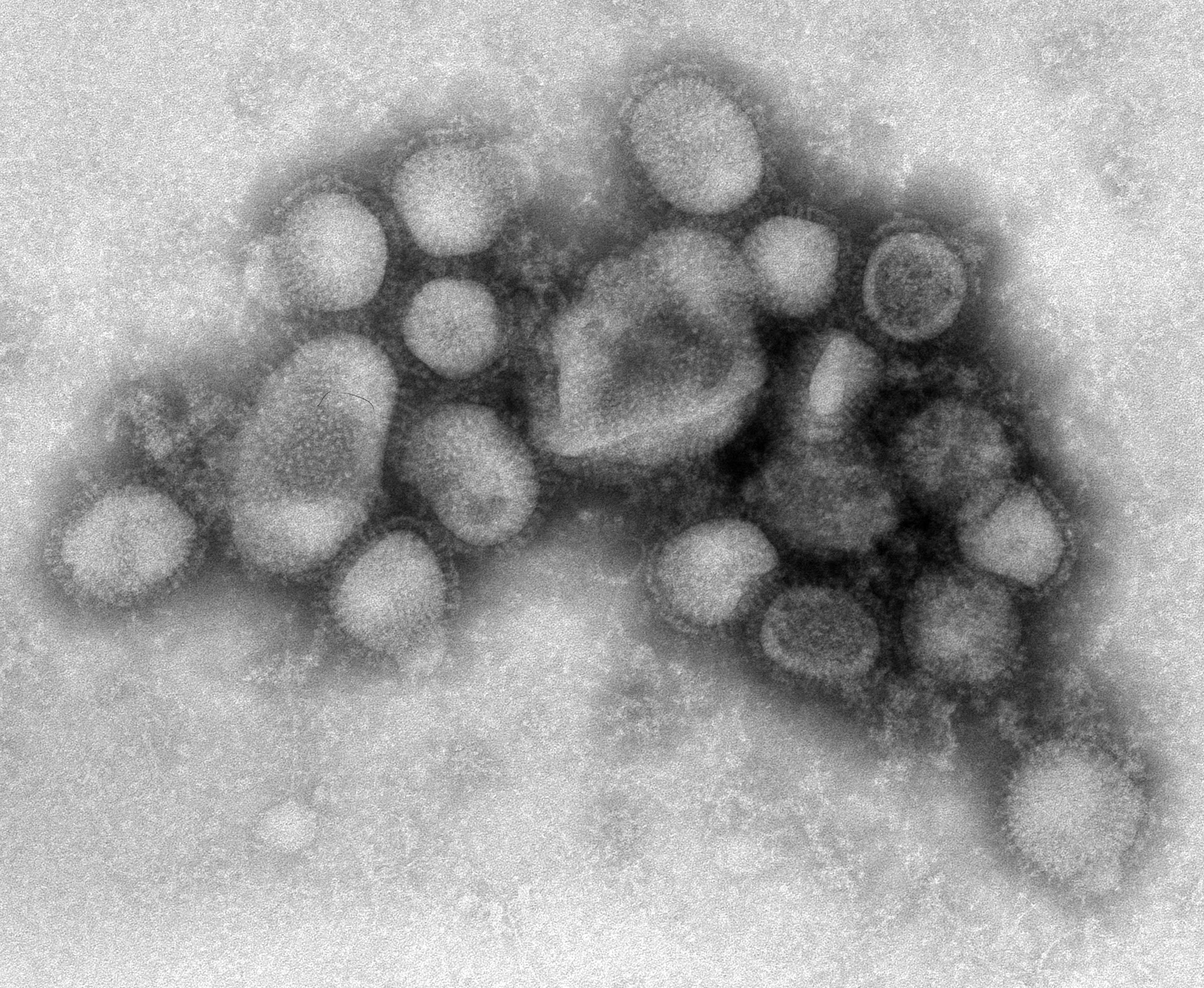 flu, Virus, Medical, Disease Wallpaper