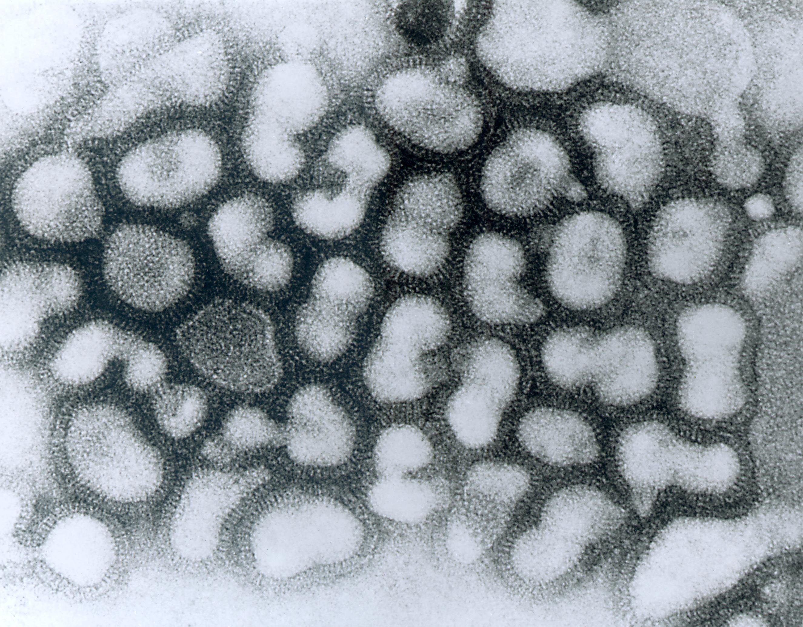 flu, Virus, Medical, Disease Wallpaper