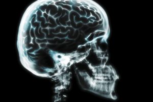 brain, Anatomy, Medical, Head, Skull, Digital, 3 d, X ray, Xray, Psychedelic