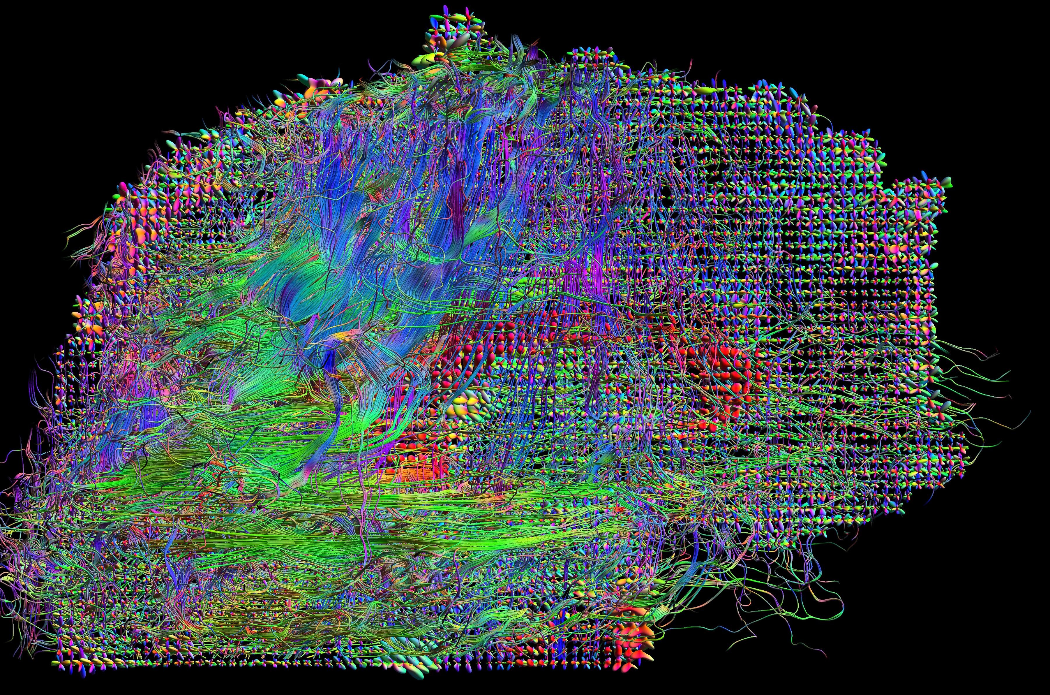 Самая большая нейросеть. Картирование мозга. Коннектом мозга. Коннектом мозга человека это. Нейронная карта мозга.