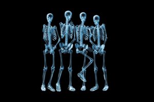 skeletons, X ray, Black, Background
