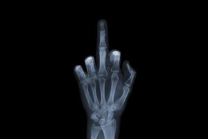 hands,  , X ray, Fuck you, Signal