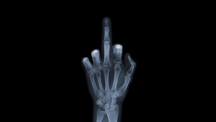 hands,  , X ray, Fuck you, Signal HD Wallpaper Desktop Background